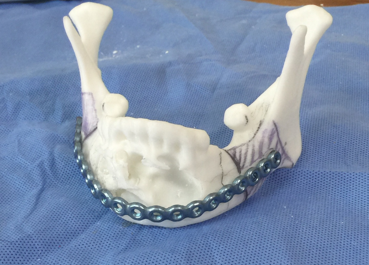 一、上颌骨复合体与上颌牙弓阻力中心位置、矫形力牵引方向的关系-儿童错(牙合)畸形早期矫治-医学